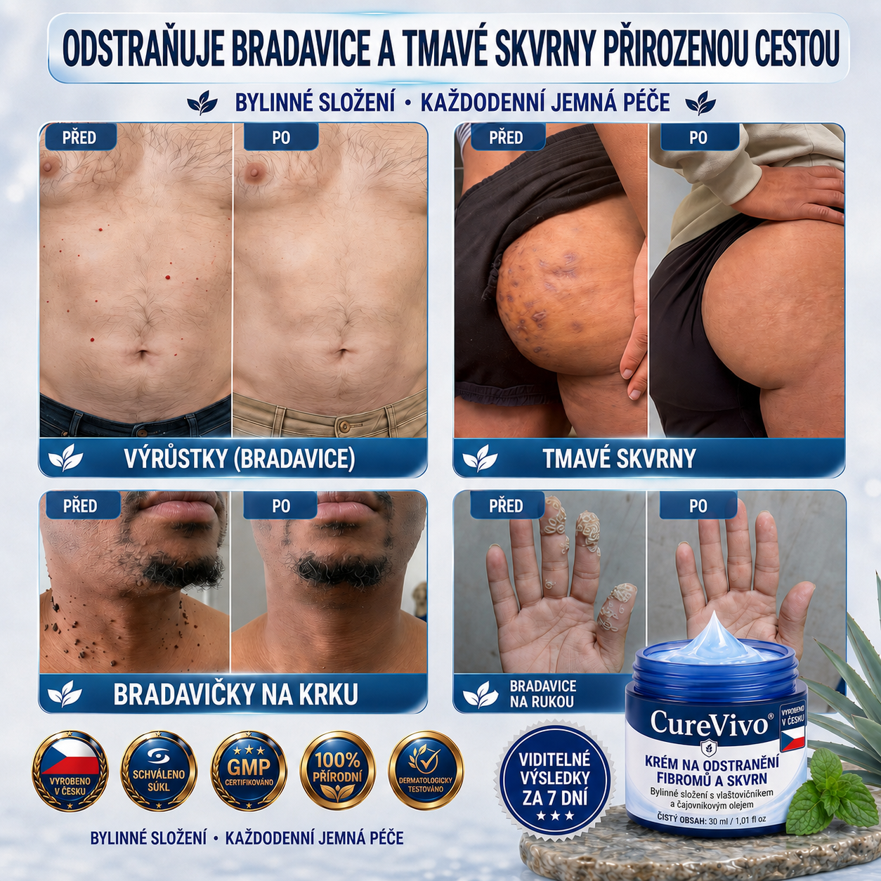 🎉 𝟕𝟎% 𝐒𝐋𝐄𝐕𝐀 | 𝐎𝐅𝐈𝐂𝐈Á𝐋𝐍Í 𝐎𝐁𝐂𝐇𝐎𝐃 𝐂𝐔𝐑𝐄𝐕𝐈𝐕𝐎® | 𝟕𝐝𝐞𝐧𝐧í 𝐤𝐫é𝐦 𝐩𝐫𝐨 𝐨𝐝𝐬𝐭𝐫𝐚𝐧ě𝐧í 𝐤𝐨ž𝐧í𝐜𝐡 𝐯ý𝐫ů𝐬𝐭𝐤ů 𝐚 𝐩𝐢𝐠𝐦𝐞𝐧𝐭𝐨𝐯ý𝐜𝐡 𝐬𝐤𝐯𝐫𝐧 – 𝐁𝐨𝐭𝐚𝐧𝐢𝐜𝐤á 𝐟𝐨𝐫𝐦𝐮𝐥𝐞 𝐯𝐲𝐫á𝐛ě𝐧á 𝐩𝐨𝐝𝐥𝐞 𝐆𝐌𝐏 𝐬𝐭𝐚𝐧𝐝𝐚𝐫𝐝ů 🍀🍀