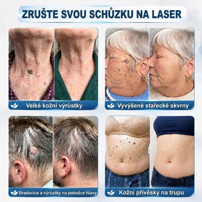 𝐎𝐟𝐢𝐜𝐢á𝐥𝐧í 𝐨𝐛𝐜𝐡𝐨𝐝 𝐳𝐧𝐚č𝐤𝐲 | ✅️ 𝐓𝐫𝐢𝐥𝐮𝐦𝐢𝐚® 𝟕𝐝𝐞𝐧𝐧í 𝐩ří𝐩𝐫𝐚𝐯𝐞𝐤 𝐧𝐚 𝐨𝐝𝐬𝐭𝐫𝐚𝐧ě𝐧í 𝐤𝐨ž𝐧í𝐜𝐡 𝐯ý𝐫ů𝐬𝐭𝐤ů 𝐚 𝐩𝐢𝐠𝐦𝐞𝐧𝐭𝐨𝐯ý𝐜𝐡 𝐬𝐤𝐯𝐫𝐧 (𝐛𝐞𝐳𝐛𝐨𝐥𝐞𝐬𝐭𝐧ý 𝐫𝐨𝐥𝐥-𝐨𝐧 𝐚𝐩𝐥𝐢𝐤á𝐭𝐨𝐫 𝐛𝐞𝐳 𝐣𝐢𝐳𝐞𝐯)