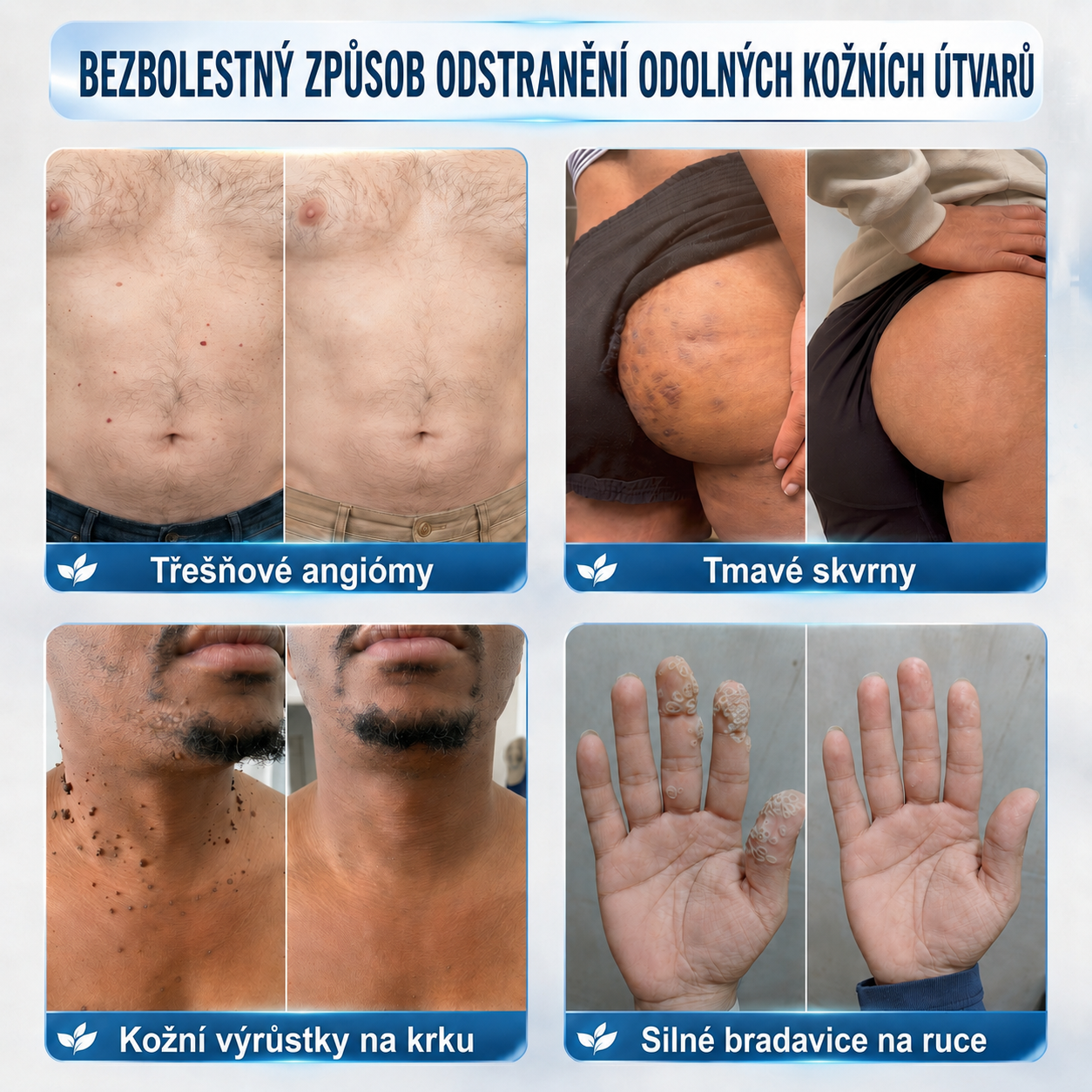 𝐎𝐟𝐢𝐜𝐢á𝐥𝐧í 𝐨𝐛𝐜𝐡𝐨𝐝 𝐳𝐧𝐚č𝐤𝐲 | ✅️ 𝐓𝐫𝐢𝐥𝐮𝐦𝐢𝐚® 𝟕𝐝𝐞𝐧𝐧í 𝐩ří𝐩𝐫𝐚𝐯𝐞𝐤 𝐧𝐚 𝐨𝐝𝐬𝐭𝐫𝐚𝐧ě𝐧í 𝐤𝐨ž𝐧í𝐜𝐡 𝐯ý𝐫ů𝐬𝐭𝐤ů 𝐚 𝐩𝐢𝐠𝐦𝐞𝐧𝐭𝐨𝐯ý𝐜𝐡 𝐬𝐤𝐯𝐫𝐧 (𝐛𝐞𝐳𝐛𝐨𝐥𝐞𝐬𝐭𝐧ý 𝐫𝐨𝐥𝐥-𝐨𝐧 𝐚𝐩𝐥𝐢𝐤á𝐭𝐨𝐫 𝐛𝐞𝐳 𝐣𝐢𝐳𝐞𝐯)