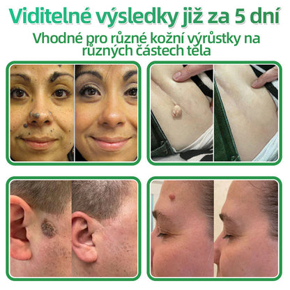 𝐇𝐮𝐝𝐫𝐨𝐬® 📌 𝟐𝐯𝟏 𝐡𝐲𝐝𝐫𝐨𝐤𝐨𝐥𝐨𝐢𝐝𝐧í 𝐧á𝐩𝐥𝐚𝐬𝐭𝐢 𝐬 𝐦𝐢𝐤𝐫𝐨𝐣𝐞𝐡𝐥𝐢č𝐤𝐚𝐦𝐢 | 𝐒𝐩𝐞𝐜𝐢á𝐥𝐧ě 𝐯𝐲𝐯𝐢𝐧𝐮𝐭é 𝐩𝐫𝐨 𝐨𝐝𝐬𝐭𝐫𝐚𝐧ě𝐧í 𝐯𝐲𝐬𝐭𝐨𝐮𝐩𝐥ý𝐜𝐡 𝐦𝐚𝐭𝐞ř𝐬𝐤ý𝐜𝐡 𝐳𝐧𝐚𝐦é𝐧𝐞𝐤, 𝐚𝐤𝐧é, 𝐩𝐥𝐨𝐜𝐡ý𝐜𝐡 𝐛𝐫𝐚𝐝𝐚𝐯𝐢𝐜 𝐚 𝐤𝐨ž𝐧í𝐜𝐡 𝐯ý𝐫ů𝐬𝐭𝐤ů | 𝐁𝐚𝐥𝐞𝐧í 𝟏𝟒𝟒 𝐤𝐮𝐬ů🌵🌵