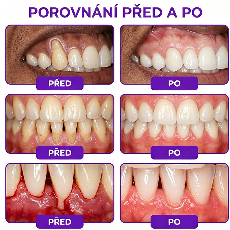 𝐇𝐄𝐀𝐓𝐖𝐎𝐋𝐅® 𝐕𝐢𝐨𝐂𝐨𝐫𝐞 𝐳𝐮𝐛𝐧í 𝐩𝐚𝐬𝐭𝐚 𝐧𝐚 𝐥éč𝐛𝐮 𝐳á𝐧ě𝐭𝐮 𝐝á𝐬𝐧í 𝐚 𝐩𝐚𝐫𝐨𝐝𝐨𝐧𝐭ó𝐳𝐲 🥬
