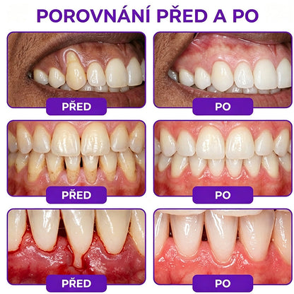 𝐇𝐄𝐀𝐓𝐖𝐎𝐋𝐅® 𝐕𝐢𝐨𝐂𝐨𝐫𝐞 𝐳𝐮𝐛𝐧í 𝐩𝐚𝐬𝐭𝐚 𝐧𝐚 𝐥éč𝐛𝐮 𝐳á𝐧ě𝐭𝐮 𝐝á𝐬𝐧í 𝐚 𝐩𝐚𝐫𝐨𝐝𝐨𝐧𝐭ó𝐳𝐲 🥬
