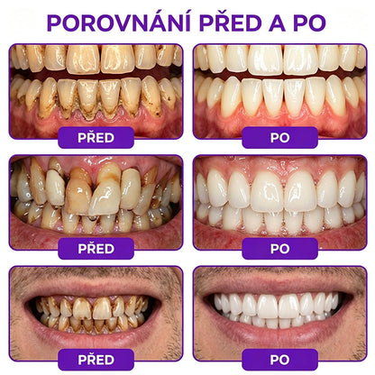 𝐇𝐄𝐀𝐓𝐖𝐎𝐋𝐅® 𝐕𝐢𝐨𝐂𝐨𝐫𝐞 𝐳𝐮𝐛𝐧í 𝐩𝐚𝐬𝐭𝐚 𝐧𝐚 𝐥éč𝐛𝐮 𝐳á𝐧ě𝐭𝐮 𝐝á𝐬𝐧í 𝐚 𝐩𝐚𝐫𝐨𝐝𝐨𝐧𝐭ó𝐳𝐲 🥬