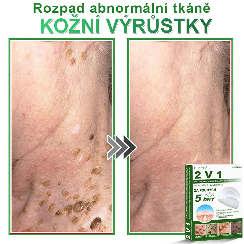 𝐇𝐮𝐝𝐫𝐨𝐬® 📌 𝟐𝐯𝟏 𝐡𝐲𝐝𝐫𝐨𝐤𝐨𝐥𝐨𝐢𝐝𝐧í 𝐧á𝐩𝐥𝐚𝐬𝐭𝐢 𝐬 𝐦𝐢𝐤𝐫𝐨𝐣𝐞𝐡𝐥𝐢č𝐤𝐚𝐦𝐢 | 𝐒𝐩𝐞𝐜𝐢á𝐥𝐧ě 𝐯𝐲𝐯𝐢𝐧𝐮𝐭é 𝐩𝐫𝐨 𝐨𝐝𝐬𝐭𝐫𝐚𝐧ě𝐧í 𝐯𝐲𝐬𝐭𝐨𝐮𝐩𝐥ý𝐜𝐡 𝐦𝐚𝐭𝐞ř𝐬𝐤ý𝐜𝐡 𝐳𝐧𝐚𝐦é𝐧𝐞𝐤, 𝐚𝐤𝐧é, 𝐩𝐥𝐨𝐜𝐡ý𝐜𝐡 𝐛𝐫𝐚𝐝𝐚𝐯𝐢𝐜 𝐚 𝐤𝐨ž𝐧í𝐜𝐡 𝐯ý𝐫ů𝐬𝐭𝐤ů | 𝐁𝐚𝐥𝐞𝐧í 𝟏𝟒𝟒 𝐤𝐮𝐬ů🌵🌵