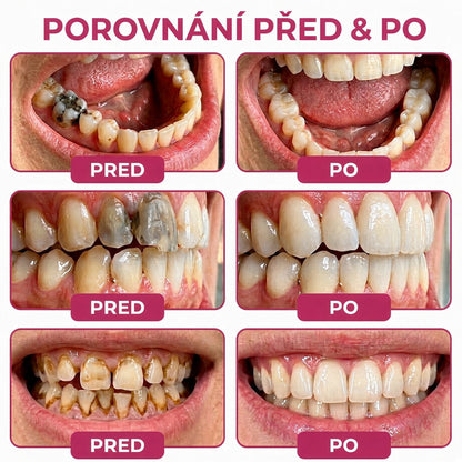 🪄 𝐓𝐫𝐢𝐥𝐮𝐦𝐢𝐚® 𝐃𝐞𝐧𝐏𝐞𝐫𝐦 – 𝐆𝐞𝐥 𝐧𝐚 𝐨𝐛𝐧𝐨𝐯𝐮 𝐳𝐮𝐛𝐧í𝐡𝐨 𝐤𝐚𝐳𝐮 𝐚 𝐩ř𝐢𝐫𝐨𝐳𝐞𝐧𝐨𝐮 𝐫𝐞𝐦𝐢𝐧𝐞𝐫𝐚𝐥𝐢𝐳𝐚𝐜𝐢 𝐳𝐮𝐛𝐧í 𝐬𝐤𝐥𝐨𝐯𝐢𝐧𝐲