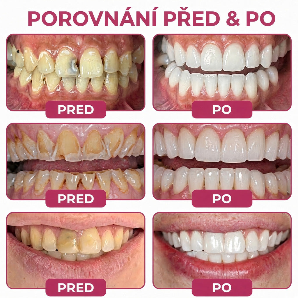 🪄 𝐓𝐫𝐢𝐥𝐮𝐦𝐢𝐚® 𝐃𝐞𝐧𝐏𝐞𝐫𝐦 – 𝐆𝐞𝐥 𝐧𝐚 𝐨𝐛𝐧𝐨𝐯𝐮 𝐳𝐮𝐛𝐧í𝐡𝐨 𝐤𝐚𝐳𝐮 𝐚 𝐩ř𝐢𝐫𝐨𝐳𝐞𝐧𝐨𝐮 𝐫𝐞𝐦𝐢𝐧𝐞𝐫𝐚𝐥𝐢𝐳𝐚𝐜𝐢 𝐳𝐮𝐛𝐧í 𝐬𝐤𝐥𝐨𝐯𝐢𝐧𝐲