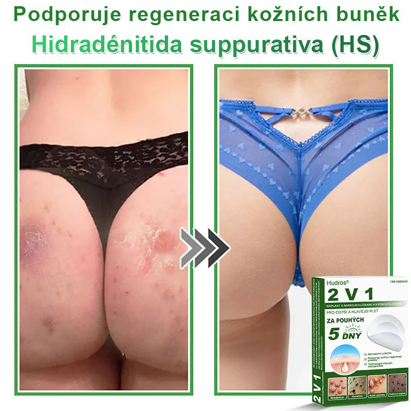 𝐇𝐮𝐝𝐫𝐨𝐬® 📌 𝟐𝐯𝟏 𝐡𝐲𝐝𝐫𝐨𝐤𝐨𝐥𝐨𝐢𝐝𝐧í 𝐧á𝐩𝐥𝐚𝐬𝐭𝐢 𝐬 𝐦𝐢𝐤𝐫𝐨𝐣𝐞𝐡𝐥𝐢č𝐤𝐚𝐦𝐢 | 𝐒𝐩𝐞𝐜𝐢á𝐥𝐧ě 𝐯𝐲𝐯𝐢𝐧𝐮𝐭é 𝐩𝐫𝐨 𝐨𝐝𝐬𝐭𝐫𝐚𝐧ě𝐧í 𝐯𝐲𝐬𝐭𝐨𝐮𝐩𝐥ý𝐜𝐡 𝐦𝐚𝐭𝐞ř𝐬𝐤ý𝐜𝐡 𝐳𝐧𝐚𝐦é𝐧𝐞𝐤, 𝐚𝐤𝐧é, 𝐩𝐥𝐨𝐜𝐡ý𝐜𝐡 𝐛𝐫𝐚𝐝𝐚𝐯𝐢𝐜 𝐚 𝐤𝐨ž𝐧í𝐜𝐡 𝐯ý𝐫ů𝐬𝐭𝐤ů | 𝐁𝐚𝐥𝐞𝐧í 𝟏𝟒𝟒 𝐤𝐮𝐬ů🌵🌵