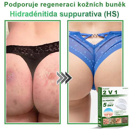 𝐇𝐮𝐝𝐫𝐨𝐬® 📌 𝟐𝐯𝟏 𝐡𝐲𝐝𝐫𝐨𝐤𝐨𝐥𝐨𝐢𝐝𝐧í 𝐧á𝐩𝐥𝐚𝐬𝐭𝐢 𝐬 𝐦𝐢𝐤𝐫𝐨𝐣𝐞𝐡𝐥𝐢č𝐤𝐚𝐦𝐢 | 𝐒𝐩𝐞𝐜𝐢á𝐥𝐧ě 𝐯𝐲𝐯𝐢𝐧𝐮𝐭é 𝐩𝐫𝐨 𝐨𝐝𝐬𝐭𝐫𝐚𝐧ě𝐧í 𝐯𝐲𝐬𝐭𝐨𝐮𝐩𝐥ý𝐜𝐡 𝐦𝐚𝐭𝐞ř𝐬𝐤ý𝐜𝐡 𝐳𝐧𝐚𝐦é𝐧𝐞𝐤, 𝐚𝐤𝐧é, 𝐩𝐥𝐨𝐜𝐡ý𝐜𝐡 𝐛𝐫𝐚𝐝𝐚𝐯𝐢𝐜 𝐚 𝐤𝐨ž𝐧í𝐜𝐡 𝐯ý𝐫ů𝐬𝐭𝐤ů | 𝐁𝐚𝐥𝐞𝐧í 𝟏𝟒𝟒 𝐤𝐮𝐬ů🌵🌵