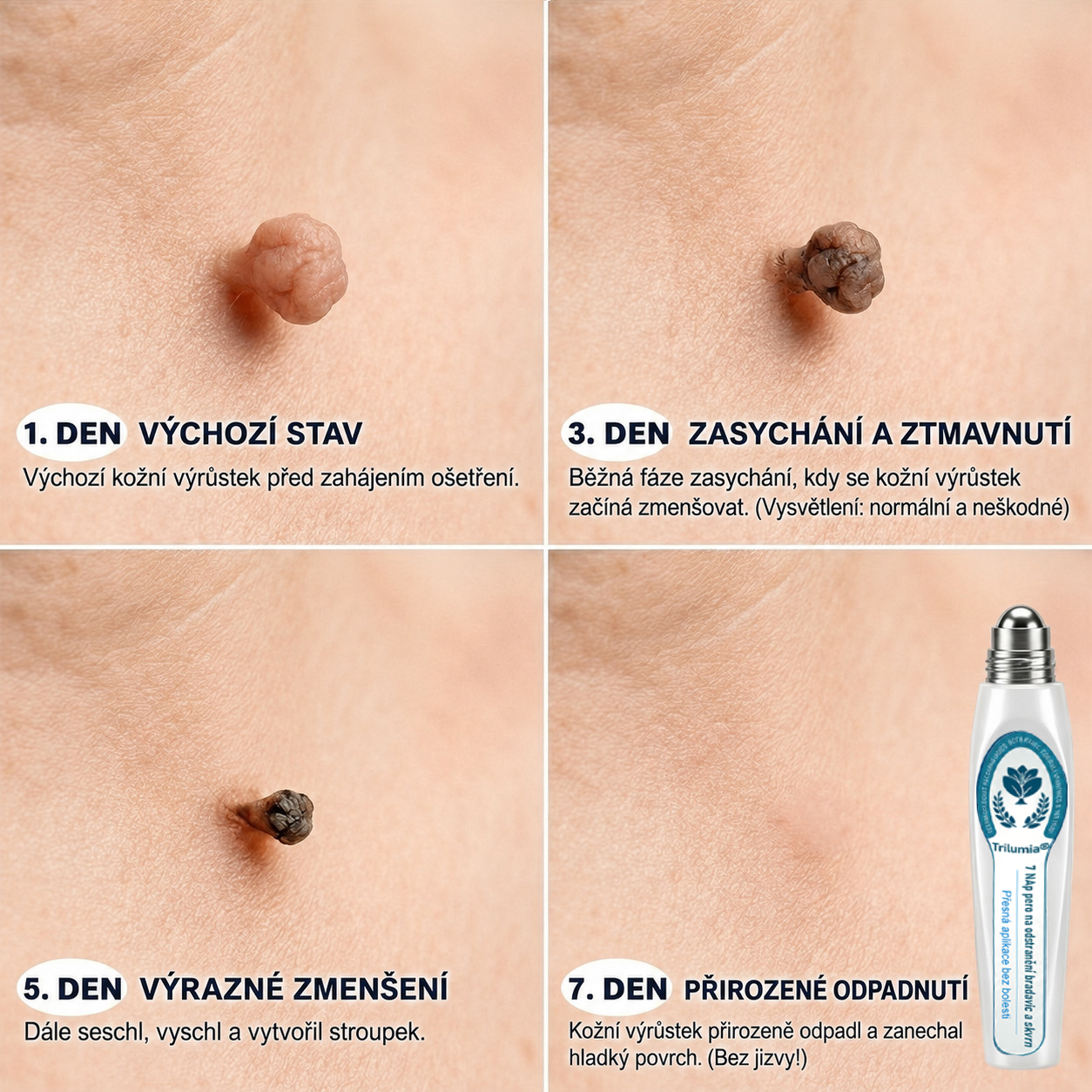 𝐎𝐟𝐢𝐜𝐢á𝐥𝐧í 𝐨𝐛𝐜𝐡𝐨𝐝 𝐳𝐧𝐚č𝐤𝐲 | ✅️ 𝐓𝐫𝐢𝐥𝐮𝐦𝐢𝐚® 𝟕𝐝𝐞𝐧𝐧í 𝐩ří𝐩𝐫𝐚𝐯𝐞𝐤 𝐧𝐚 𝐨𝐝𝐬𝐭𝐫𝐚𝐧ě𝐧í 𝐤𝐨ž𝐧í𝐜𝐡 𝐯ý𝐫ů𝐬𝐭𝐤ů 𝐚 𝐩𝐢𝐠𝐦𝐞𝐧𝐭𝐨𝐯ý𝐜𝐡 𝐬𝐤𝐯𝐫𝐧 (𝐛𝐞𝐳𝐛𝐨𝐥𝐞𝐬𝐭𝐧ý 𝐫𝐨𝐥𝐥-𝐨𝐧 𝐚𝐩𝐥𝐢𝐤á𝐭𝐨𝐫 𝐛𝐞𝐳 𝐣𝐢𝐳𝐞𝐯)