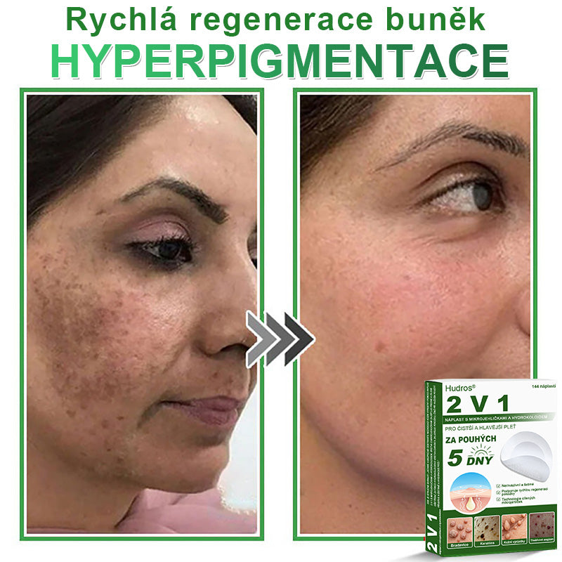 𝐇𝐮𝐝𝐫𝐨𝐬® 📌 𝟐𝐯𝟏 𝐡𝐲𝐝𝐫𝐨𝐤𝐨𝐥𝐨𝐢𝐝𝐧í 𝐧á𝐩𝐥𝐚𝐬𝐭𝐢 𝐬 𝐦𝐢𝐤𝐫𝐨𝐣𝐞𝐡𝐥𝐢č𝐤𝐚𝐦𝐢 | 𝐒𝐩𝐞𝐜𝐢á𝐥𝐧ě 𝐯𝐲𝐯𝐢𝐧𝐮𝐭é 𝐩𝐫𝐨 𝐨𝐝𝐬𝐭𝐫𝐚𝐧ě𝐧í 𝐯𝐲𝐬𝐭𝐨𝐮𝐩𝐥ý𝐜𝐡 𝐦𝐚𝐭𝐞ř𝐬𝐤ý𝐜𝐡 𝐳𝐧𝐚𝐦é𝐧𝐞𝐤, 𝐚𝐤𝐧é, 𝐩𝐥𝐨𝐜𝐡ý𝐜𝐡 𝐛𝐫𝐚𝐝𝐚𝐯𝐢𝐜 𝐚 𝐤𝐨ž𝐧í𝐜𝐡 𝐯ý𝐫ů𝐬𝐭𝐤ů | 𝐁𝐚𝐥𝐞𝐧í 𝟏𝟒𝟒 𝐤𝐮𝐬ů🌵🌵