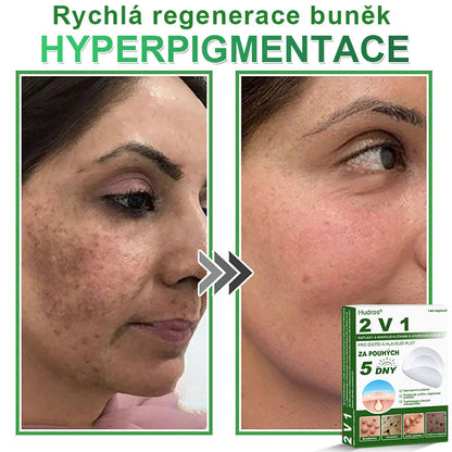 𝐇𝐮𝐝𝐫𝐨𝐬® 📌 𝟐𝐯𝟏 𝐡𝐲𝐝𝐫𝐨𝐤𝐨𝐥𝐨𝐢𝐝𝐧í 𝐧á𝐩𝐥𝐚𝐬𝐭𝐢 𝐬 𝐦𝐢𝐤𝐫𝐨𝐣𝐞𝐡𝐥𝐢č𝐤𝐚𝐦𝐢 | 𝐒𝐩𝐞𝐜𝐢á𝐥𝐧ě 𝐯𝐲𝐯𝐢𝐧𝐮𝐭é 𝐩𝐫𝐨 𝐨𝐝𝐬𝐭𝐫𝐚𝐧ě𝐧í 𝐯𝐲𝐬𝐭𝐨𝐮𝐩𝐥ý𝐜𝐡 𝐦𝐚𝐭𝐞ř𝐬𝐤ý𝐜𝐡 𝐳𝐧𝐚𝐦é𝐧𝐞𝐤, 𝐚𝐤𝐧é, 𝐩𝐥𝐨𝐜𝐡ý𝐜𝐡 𝐛𝐫𝐚𝐝𝐚𝐯𝐢𝐜 𝐚 𝐤𝐨ž𝐧í𝐜𝐡 𝐯ý𝐫ů𝐬𝐭𝐤ů | 𝐁𝐚𝐥𝐞𝐧í 𝟏𝟒𝟒 𝐤𝐮𝐬ů🌵🌵