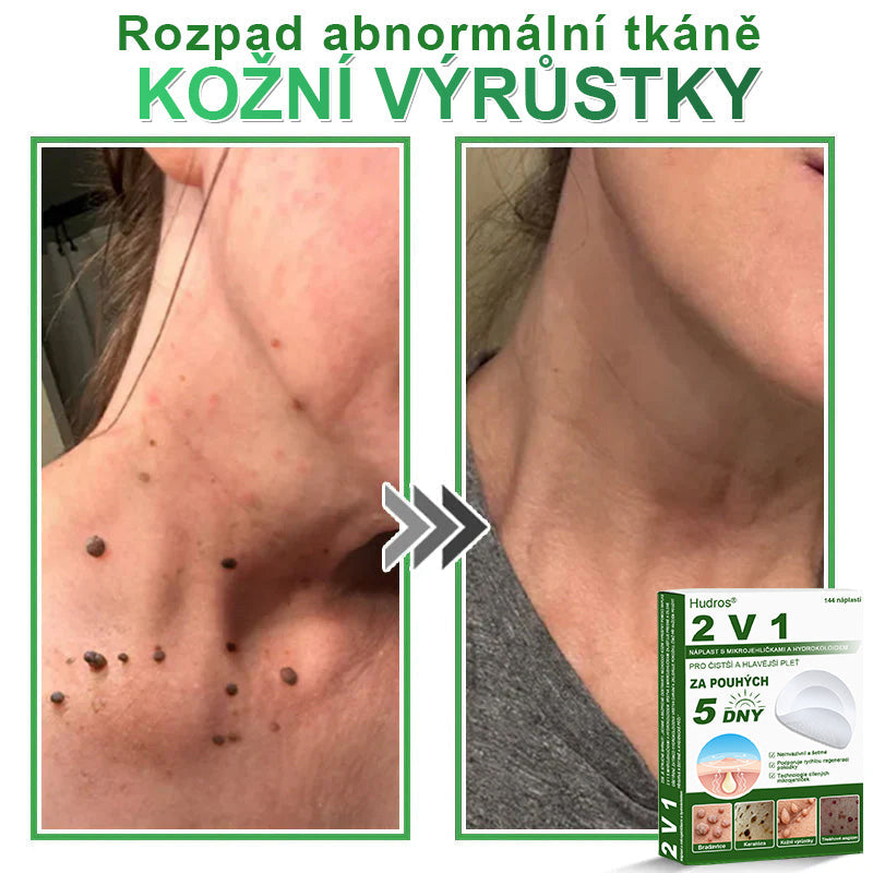 𝐇𝐮𝐝𝐫𝐨𝐬® 📌 𝟐𝐯𝟏 𝐡𝐲𝐝𝐫𝐨𝐤𝐨𝐥𝐨𝐢𝐝𝐧í 𝐧á𝐩𝐥𝐚𝐬𝐭𝐢 𝐬 𝐦𝐢𝐤𝐫𝐨𝐣𝐞𝐡𝐥𝐢č𝐤𝐚𝐦𝐢 | 𝐒𝐩𝐞𝐜𝐢á𝐥𝐧ě 𝐯𝐲𝐯𝐢𝐧𝐮𝐭é 𝐩𝐫𝐨 𝐨𝐝𝐬𝐭𝐫𝐚𝐧ě𝐧í 𝐯𝐲𝐬𝐭𝐨𝐮𝐩𝐥ý𝐜𝐡 𝐦𝐚𝐭𝐞ř𝐬𝐤ý𝐜𝐡 𝐳𝐧𝐚𝐦é𝐧𝐞𝐤, 𝐚𝐤𝐧é, 𝐩𝐥𝐨𝐜𝐡ý𝐜𝐡 𝐛𝐫𝐚𝐝𝐚𝐯𝐢𝐜 𝐚 𝐤𝐨ž𝐧í𝐜𝐡 𝐯ý𝐫ů𝐬𝐭𝐤ů | 𝐁𝐚𝐥𝐞𝐧í 𝟏𝟒𝟒 𝐤𝐮𝐬ů🌵🌵