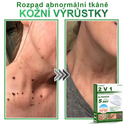 𝐇𝐮𝐝𝐫𝐨𝐬® 📌 𝟐𝐯𝟏 𝐡𝐲𝐝𝐫𝐨𝐤𝐨𝐥𝐨𝐢𝐝𝐧í 𝐧á𝐩𝐥𝐚𝐬𝐭𝐢 𝐬 𝐦𝐢𝐤𝐫𝐨𝐣𝐞𝐡𝐥𝐢č𝐤𝐚𝐦𝐢 | 𝐒𝐩𝐞𝐜𝐢á𝐥𝐧ě 𝐯𝐲𝐯𝐢𝐧𝐮𝐭é 𝐩𝐫𝐨 𝐨𝐝𝐬𝐭𝐫𝐚𝐧ě𝐧í 𝐯𝐲𝐬𝐭𝐨𝐮𝐩𝐥ý𝐜𝐡 𝐦𝐚𝐭𝐞ř𝐬𝐤ý𝐜𝐡 𝐳𝐧𝐚𝐦é𝐧𝐞𝐤, 𝐚𝐤𝐧é, 𝐩𝐥𝐨𝐜𝐡ý𝐜𝐡 𝐛𝐫𝐚𝐝𝐚𝐯𝐢𝐜 𝐚 𝐤𝐨ž𝐧í𝐜𝐡 𝐯ý𝐫ů𝐬𝐭𝐤ů | 𝐁𝐚𝐥𝐞𝐧í 𝟏𝟒𝟒 𝐤𝐮𝐬ů🌵🌵