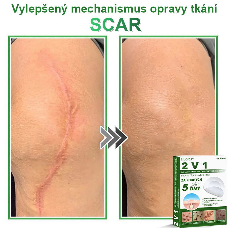 𝐇𝐮𝐝𝐫𝐨𝐬® 📌 𝟐𝐯𝟏 𝐡𝐲𝐝𝐫𝐨𝐤𝐨𝐥𝐨𝐢𝐝𝐧í 𝐧á𝐩𝐥𝐚𝐬𝐭𝐢 𝐬 𝐦𝐢𝐤𝐫𝐨𝐣𝐞𝐡𝐥𝐢č𝐤𝐚𝐦𝐢 | 𝐒𝐩𝐞𝐜𝐢á𝐥𝐧ě 𝐯𝐲𝐯𝐢𝐧𝐮𝐭é 𝐩𝐫𝐨 𝐨𝐝𝐬𝐭𝐫𝐚𝐧ě𝐧í 𝐯𝐲𝐬𝐭𝐨𝐮𝐩𝐥ý𝐜𝐡 𝐦𝐚𝐭𝐞ř𝐬𝐤ý𝐜𝐡 𝐳𝐧𝐚𝐦é𝐧𝐞𝐤, 𝐚𝐤𝐧é, 𝐩𝐥𝐨𝐜𝐡ý𝐜𝐡 𝐛𝐫𝐚𝐝𝐚𝐯𝐢𝐜 𝐚 𝐤𝐨ž𝐧í𝐜𝐡 𝐯ý𝐫ů𝐬𝐭𝐤ů | 𝐁𝐚𝐥𝐞𝐧í 𝟏𝟒𝟒 𝐤𝐮𝐬ů🌵🌵