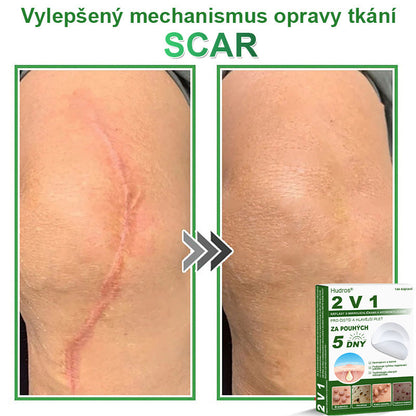 𝐇𝐮𝐝𝐫𝐨𝐬® 📌 𝟐𝐯𝟏 𝐡𝐲𝐝𝐫𝐨𝐤𝐨𝐥𝐨𝐢𝐝𝐧í 𝐧á𝐩𝐥𝐚𝐬𝐭𝐢 𝐬 𝐦𝐢𝐤𝐫𝐨𝐣𝐞𝐡𝐥𝐢č𝐤𝐚𝐦𝐢 | 𝐒𝐩𝐞𝐜𝐢á𝐥𝐧ě 𝐯𝐲𝐯𝐢𝐧𝐮𝐭é 𝐩𝐫𝐨 𝐨𝐝𝐬𝐭𝐫𝐚𝐧ě𝐧í 𝐯𝐲𝐬𝐭𝐨𝐮𝐩𝐥ý𝐜𝐡 𝐦𝐚𝐭𝐞ř𝐬𝐤ý𝐜𝐡 𝐳𝐧𝐚𝐦é𝐧𝐞𝐤, 𝐚𝐤𝐧é, 𝐩𝐥𝐨𝐜𝐡ý𝐜𝐡 𝐛𝐫𝐚𝐝𝐚𝐯𝐢𝐜 𝐚 𝐤𝐨ž𝐧í𝐜𝐡 𝐯ý𝐫ů𝐬𝐭𝐤ů | 𝐁𝐚𝐥𝐞𝐧í 𝟏𝟒𝟒 𝐤𝐮𝐬ů🌵🌵