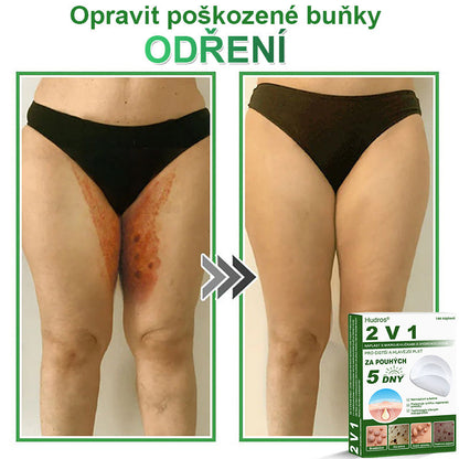 𝐇𝐮𝐝𝐫𝐨𝐬® 📌 𝟐𝐯𝟏 𝐡𝐲𝐝𝐫𝐨𝐤𝐨𝐥𝐨𝐢𝐝𝐧í 𝐧á𝐩𝐥𝐚𝐬𝐭𝐢 𝐬 𝐦𝐢𝐤𝐫𝐨𝐣𝐞𝐡𝐥𝐢č𝐤𝐚𝐦𝐢 | 𝐒𝐩𝐞𝐜𝐢á𝐥𝐧ě 𝐯𝐲𝐯𝐢𝐧𝐮𝐭é 𝐩𝐫𝐨 𝐨𝐝𝐬𝐭𝐫𝐚𝐧ě𝐧í 𝐯𝐲𝐬𝐭𝐨𝐮𝐩𝐥ý𝐜𝐡 𝐦𝐚𝐭𝐞ř𝐬𝐤ý𝐜𝐡 𝐳𝐧𝐚𝐦é𝐧𝐞𝐤, 𝐚𝐤𝐧é, 𝐩𝐥𝐨𝐜𝐡ý𝐜𝐡 𝐛𝐫𝐚𝐝𝐚𝐯𝐢𝐜 𝐚 𝐤𝐨ž𝐧í𝐜𝐡 𝐯ý𝐫ů𝐬𝐭𝐤ů | 𝐁𝐚𝐥𝐞𝐧í 𝟏𝟒𝟒 𝐤𝐮𝐬ů🌵🌵
